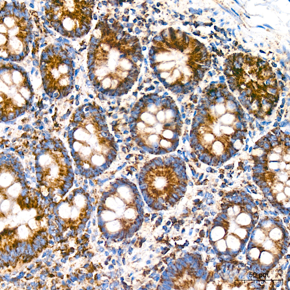 BCL2L14/BCLG Rabbit Monoclonal Antibody - Image 4