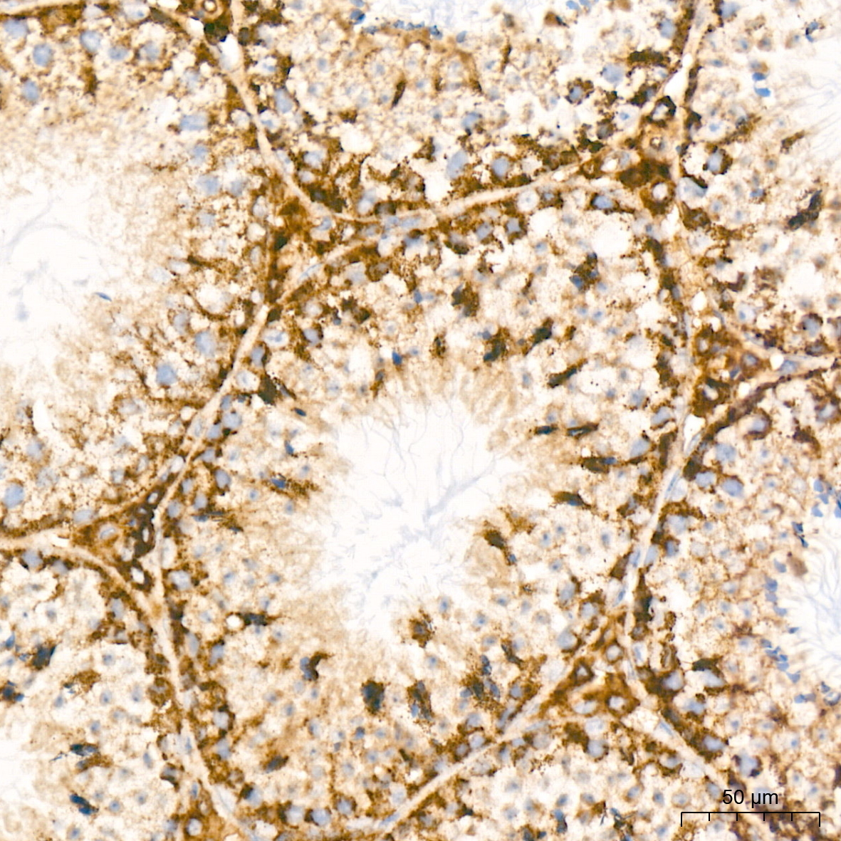 BCL2L14/BCLG Rabbit Monoclonal Antibody - Image 5