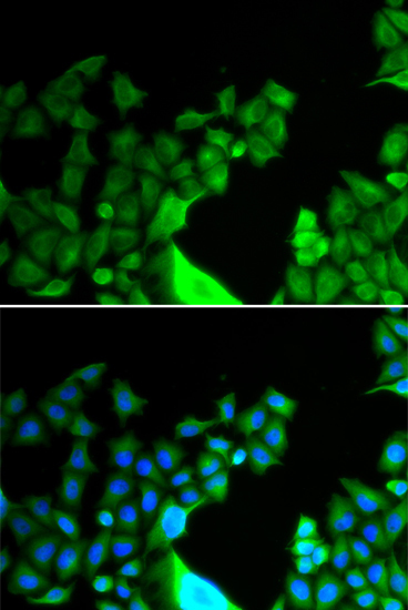 BCL2L14/BCLG Rabbit Polyclonal Antibody - Image 2