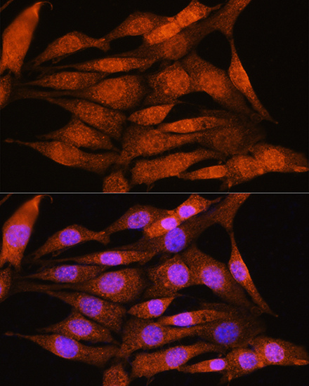 BCL3 Rabbit Polyclonal Antibody - Image 2