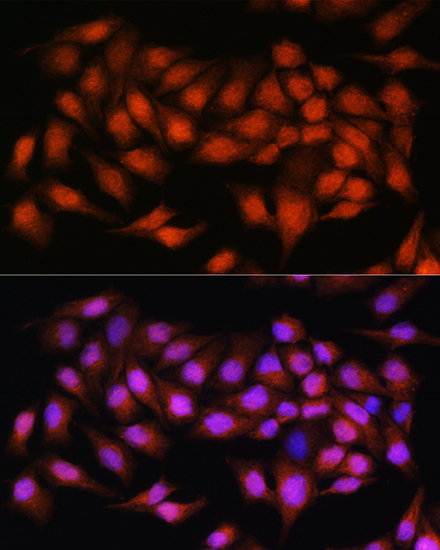 BCL3 Rabbit Polyclonal Antibody - Image 3