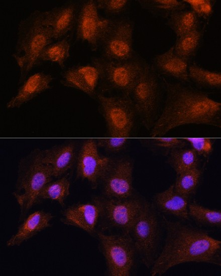 BCL3 Rabbit Polyclonal Antibody - Image 4