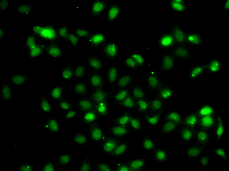 BCL6 Rabbit Polyclonal Antibody - Image 2