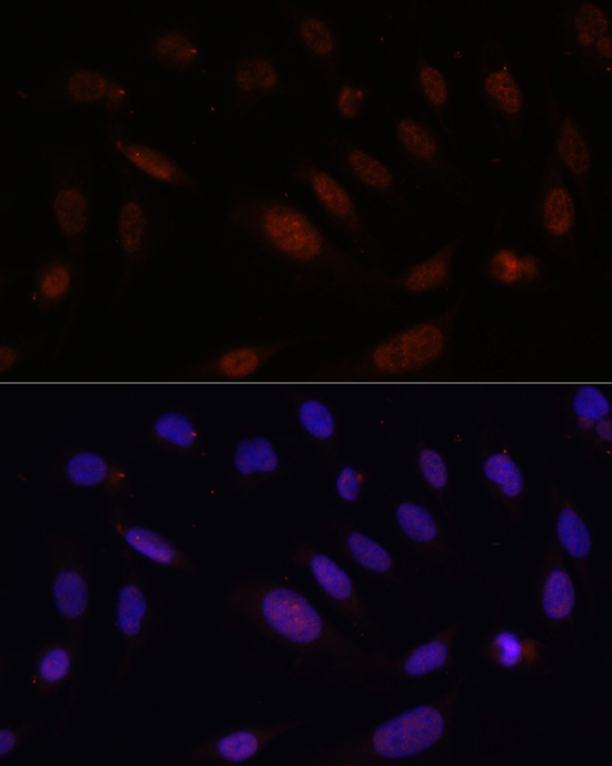 Bcl9 Rabbit Polyclonal Antibody