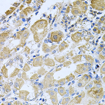 BCR Rabbit Polyclonal Antibody - Image 2