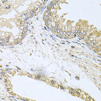 BCR Rabbit Polyclonal Antibody - Image 3