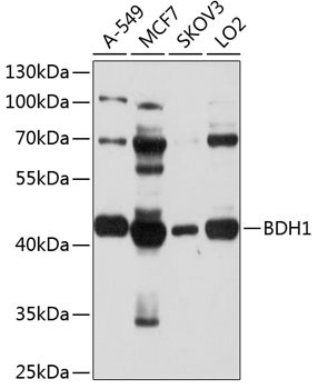 BDH1 Rabbit Polyclonal Antibody