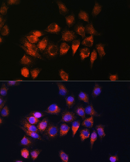 BDKRB2 Rabbit Polyclonal Antibody - Image 2