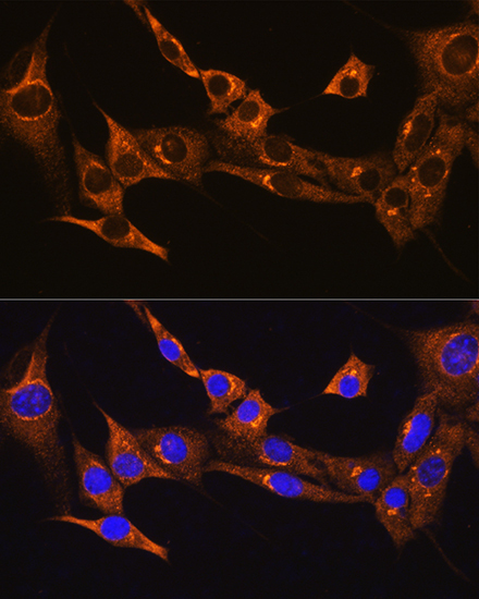 BDKRB2 Rabbit Polyclonal Antibody - Image 3