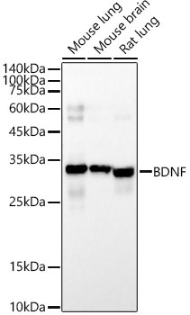 BDNF Mouse Monoclonal Antibody