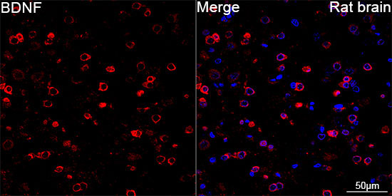 BDNF Rabbit Monoclonal Antibody
