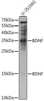 BDNF Rabbit Polyclonal Antibody