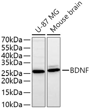 BDNF Rabbit Polyclonal Antibody