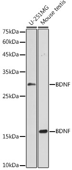 BDNF Rabbit Polyclonal Antibody