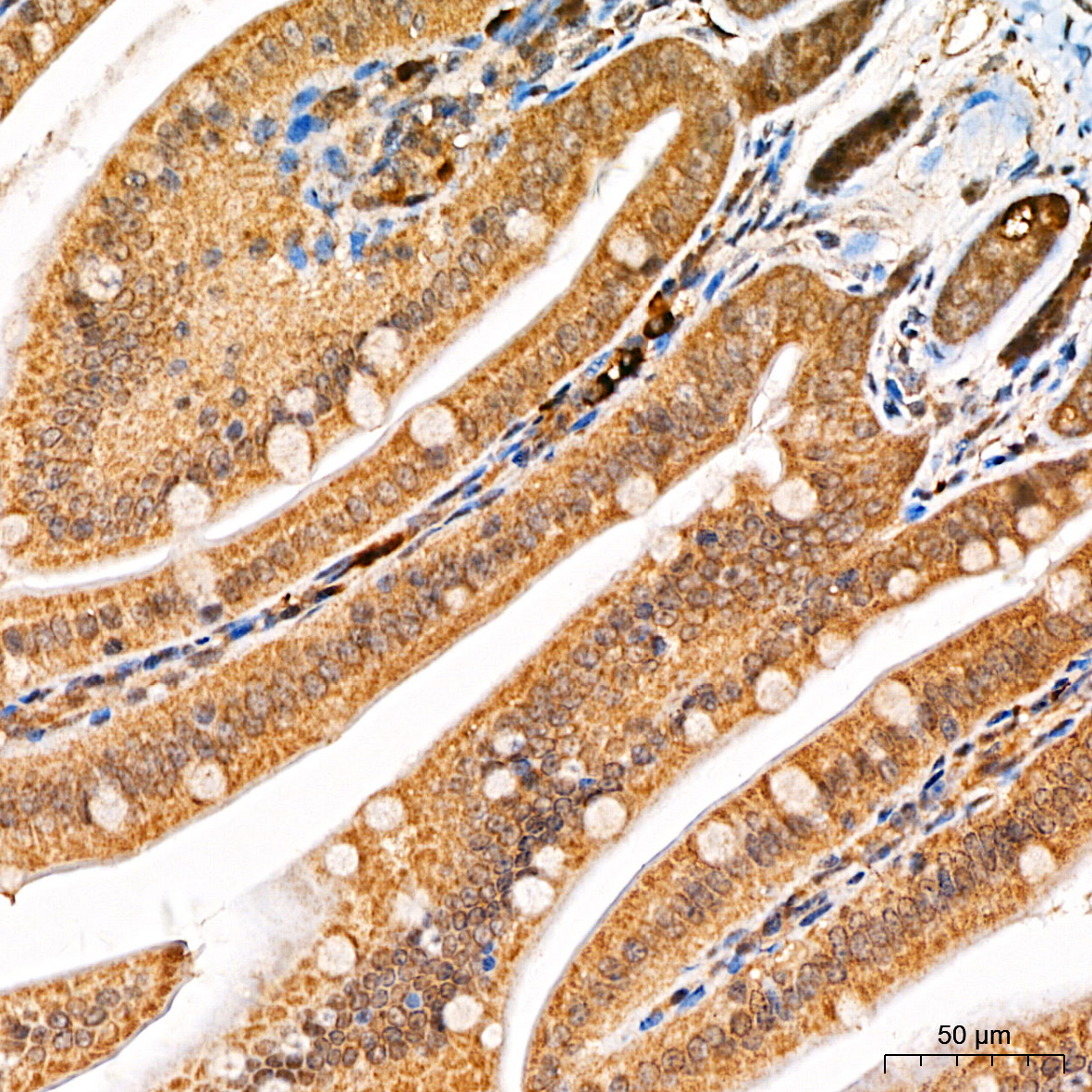 Beclin 1 Rabbit Polyclonal Antibody - Image 2