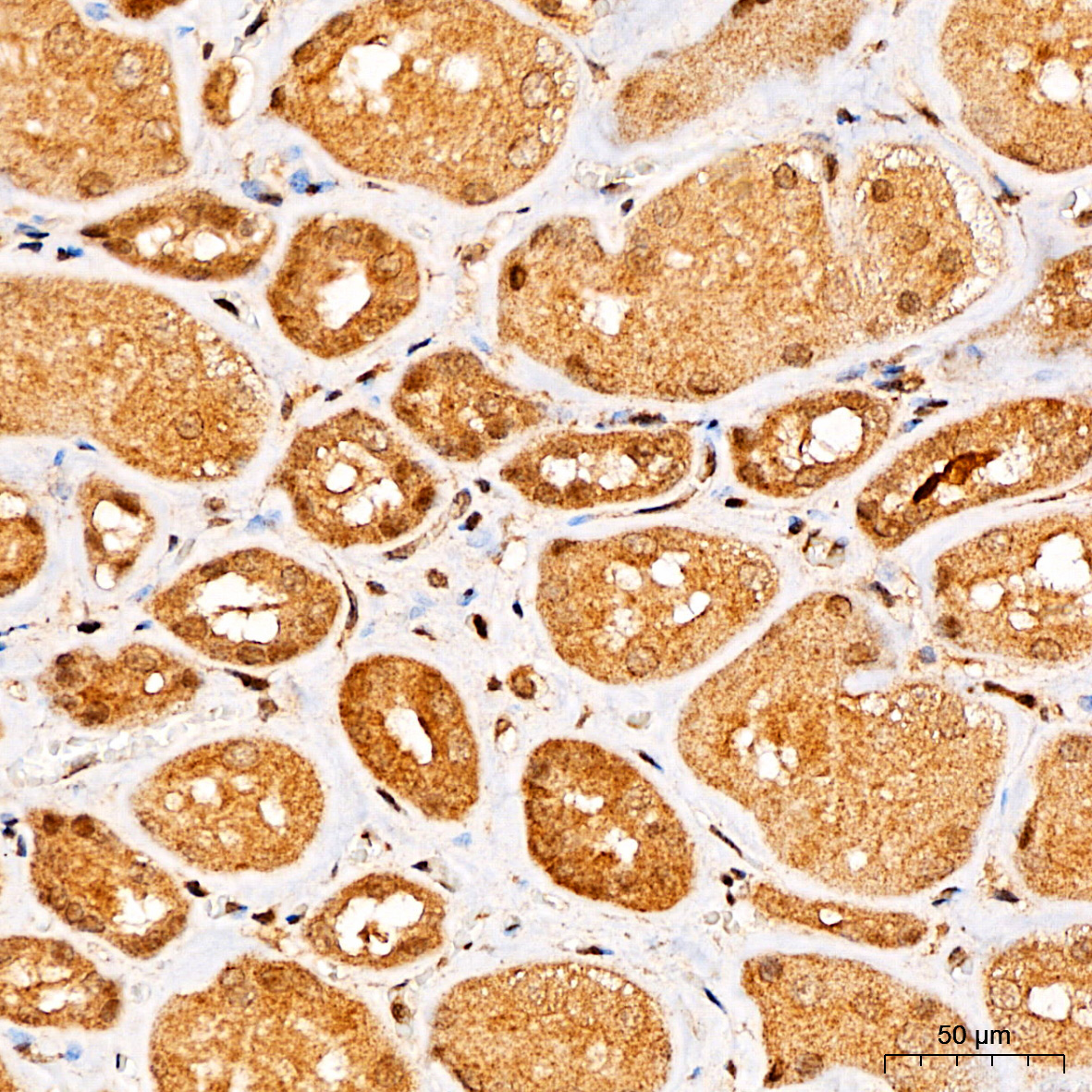 Beclin 1 Rabbit Polyclonal Antibody - Image 3