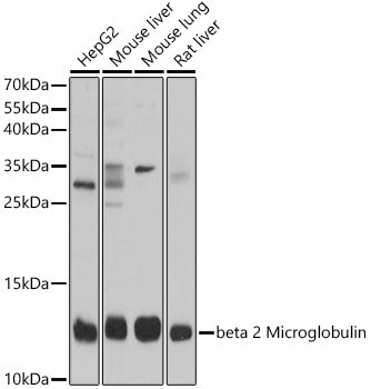 beta 2 Microglobulin Rabbit Polyclonal Antibody