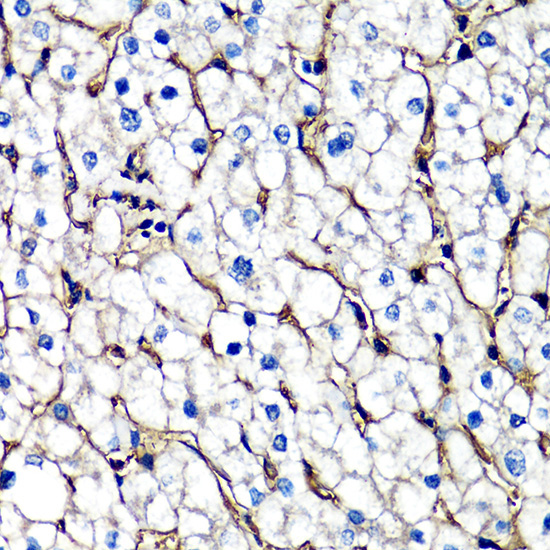 beta 2 Microglobulin Rabbit Polyclonal Antibody - Image 2