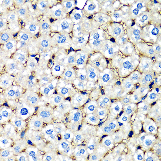 beta 2 Microglobulin Rabbit Polyclonal Antibody - Image 3