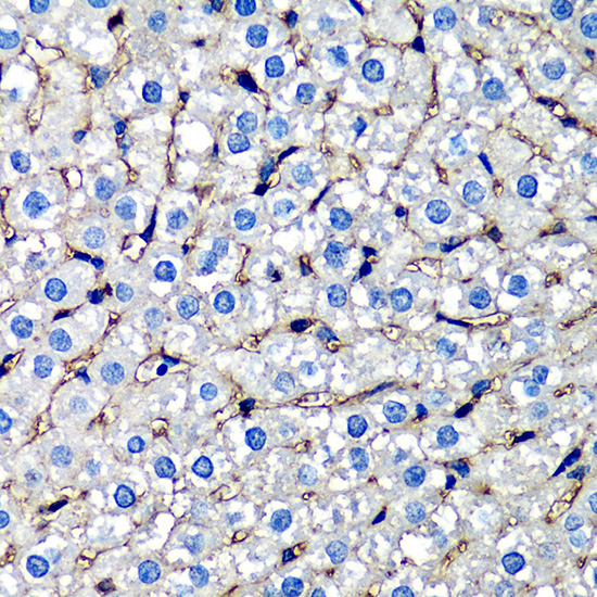 beta 2 Microglobulin Rabbit Polyclonal Antibody - Image 4