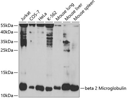 beta 2 Microglobulin Rabbit Polyclonal Antibody