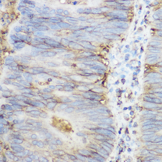 beta 2 Microglobulin Rabbit Polyclonal Antibody - Image 2