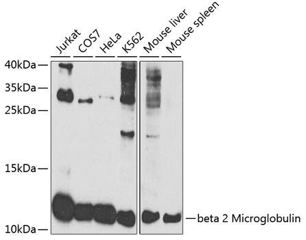 beta 2 Microglobulin Rabbit Polyclonal Antibody