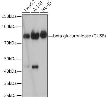 beta glucuronidase (GUSB) Rabbit Monoclonal Antibody