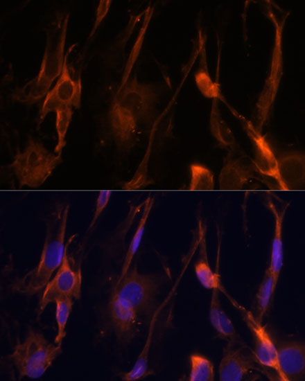 BFAR Rabbit Polyclonal Antibody - Image 2