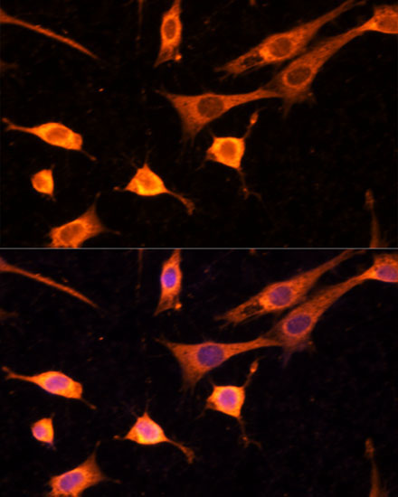 BFAR Rabbit Polyclonal Antibody - Image 3
