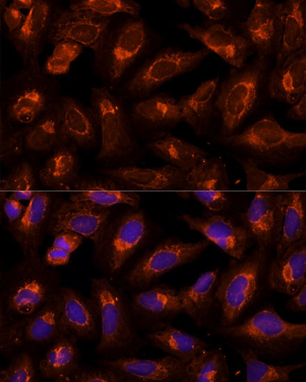 BFAR Rabbit Polyclonal Antibody - Image 4