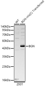 BGN Rabbit Polyclonal Antibody