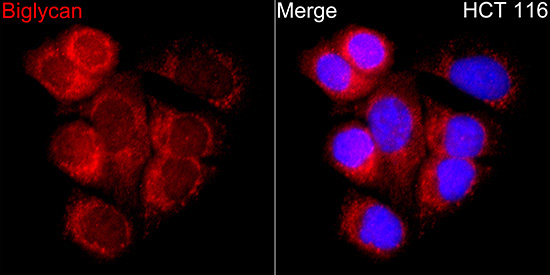 BGN Rabbit Polyclonal Antibody - Image 2