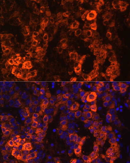 BHMT Rabbit Polyclonal Antibody - Image 3