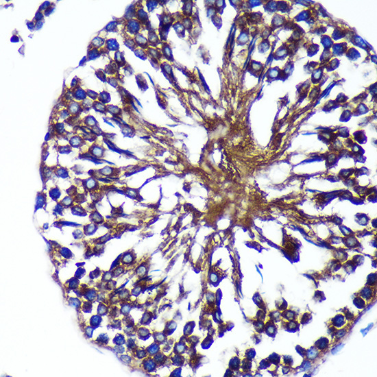 Bif-1 Rabbit Polyclonal Antibody - Image 2