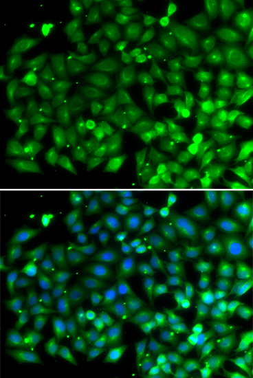 Bif-1 Rabbit Polyclonal Antibody