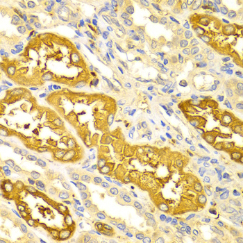 BIN1 Rabbit Polyclonal Antibody - Image 2