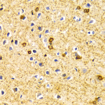 BIN1 Rabbit Polyclonal Antibody - Image 3