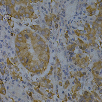 BIN1 Rabbit Polyclonal Antibody - Image 4