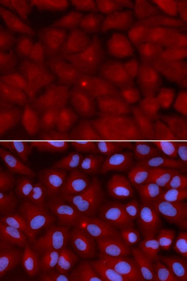BIN1 Rabbit Polyclonal Antibody - Image 5