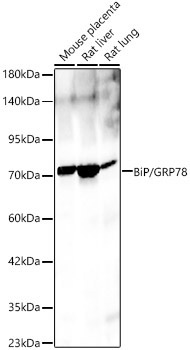 BiP/GRP78 Rabbit Polyclonal Antibody - Image 2