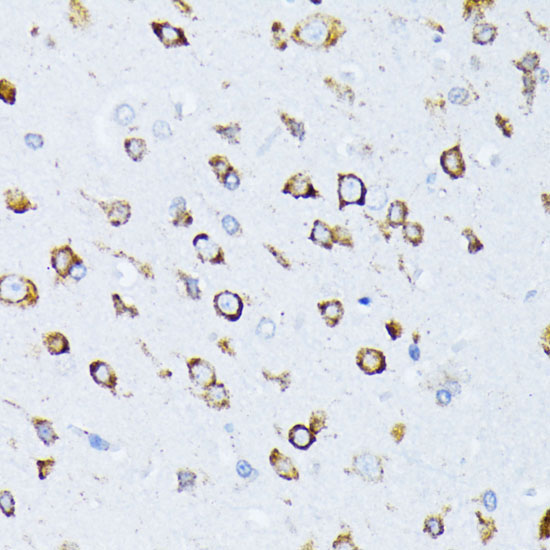 BiP/GRP78 Rabbit Polyclonal Antibody - Image 3