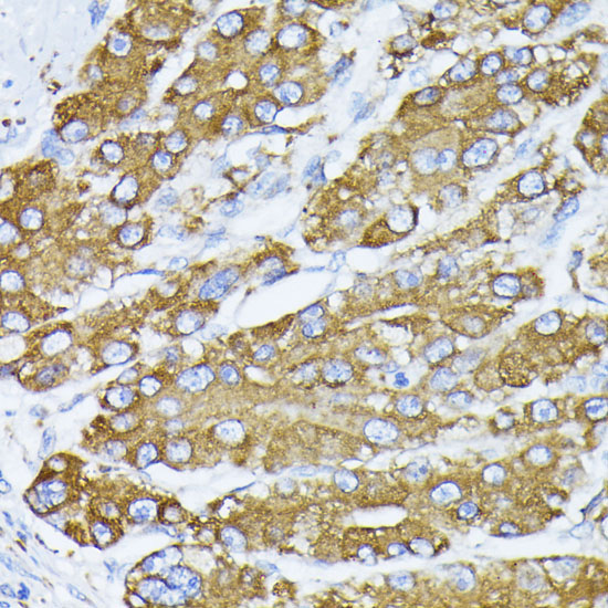 BiP/GRP78 Rabbit Polyclonal Antibody - Image 4