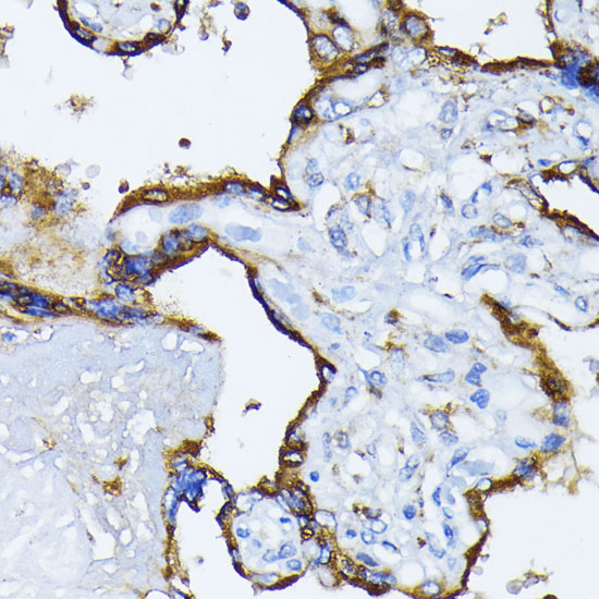 BiP/GRP78 Rabbit Polyclonal Antibody - Image 5