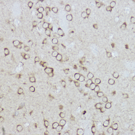 BiP/GRP78 Rabbit Polyclonal Antibody - Image 2