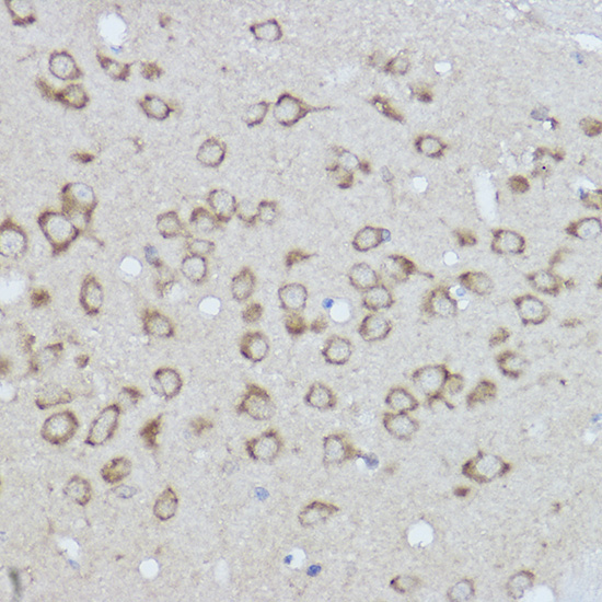 BiP/GRP78 Rabbit Polyclonal Antibody - Image 3