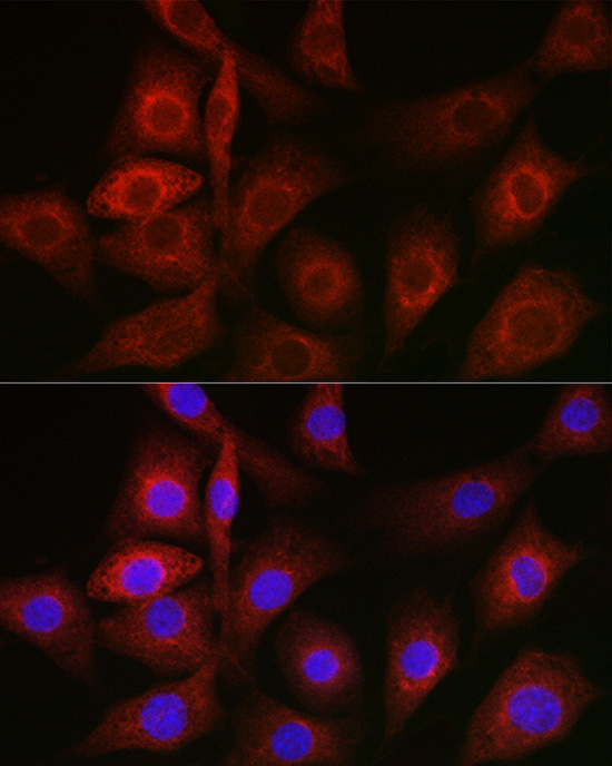BiP/GRP78 Rabbit Polyclonal Antibody - Image 4