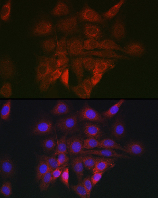 BiP/GRP78 Rabbit Polyclonal Antibody - Image 5