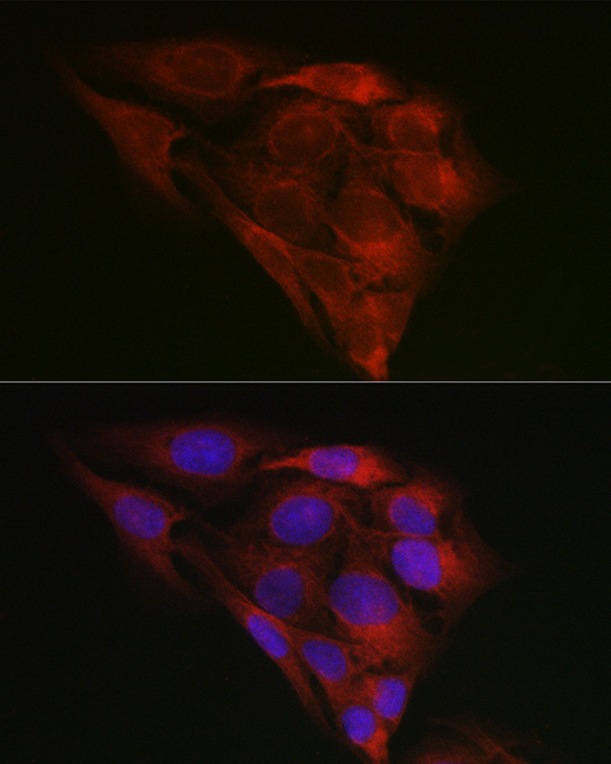 BiP/GRP78 Rabbit Polyclonal Antibody - Image 6