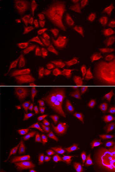 BLMH Rabbit Polyclonal Antibody - Image 2